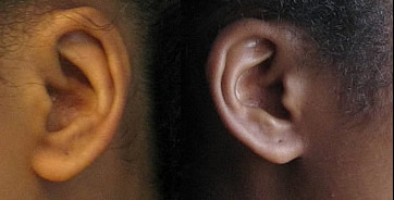 ear-drawing