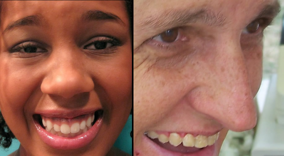 facial parts