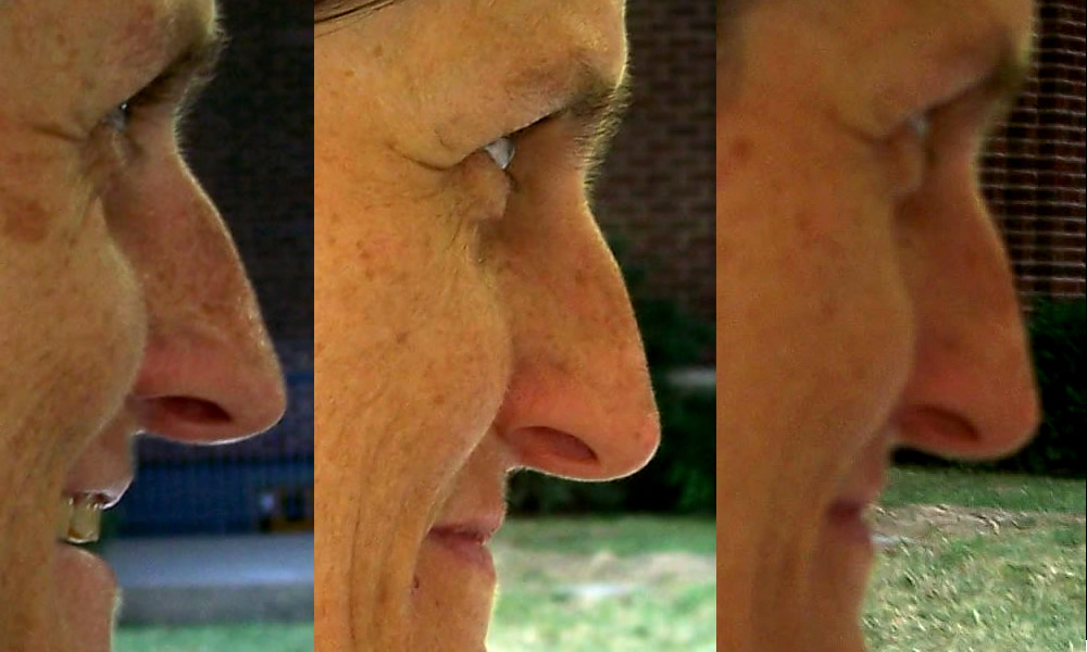 facial parts